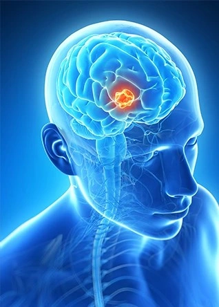 Traumatic Brain Injury Evaluations at ImpactMD.